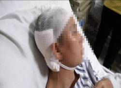 Người phụ nữ bị khoan thủng màng nhĩ, suýt chết vì viêm tai giữa, nguyên nhân xuất phát từ hành động chủ quan khi gội đầu - Ảnh 1. Người phụ nữ bị khoan thủng màng nhĩ, suýt chết vì viêm tai giữa, nguyên nhân xuất phát từ hành động chủ quan khi gội đầu - Ảnh 1.