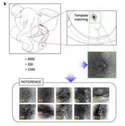  Chiếc bồn cầu thông minh thực sự, có cả camera nhận diện vân hậu môn của chủ nhân  - Ảnh 3.